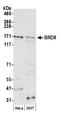 Bromodomain Containing 8 antibody, A300-220A, Bethyl Labs, Western Blot image 