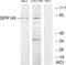 G Protein-Coupled Receptor 149 antibody, A30812, Boster Biological Technology, Western Blot image 