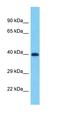 PRAME Family Member 19 antibody, orb327179, Biorbyt, Western Blot image 