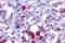 Arginine Vasopressin Receptor 1B antibody, GTX78015, GeneTex, Immunohistochemistry paraffin image 
