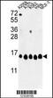Histone Cluster 1 H2A Family Member H antibody, MBS9207636, MyBioSource, Western Blot image 