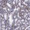 Galectin 3 Binding Protein antibody, PA5-51411, Invitrogen Antibodies, Immunohistochemistry paraffin image 