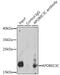 Apolipoprotein B MRNA Editing Enzyme Catalytic Subunit 3C antibody, 15-577, ProSci, Immunoprecipitation image 