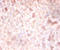 DNA Methyltransferase 3 Alpha antibody, LS-C285490, Lifespan Biosciences, Immunohistochemistry paraffin image 