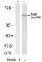 Neurotrophic Receptor Tyrosine Kinase 2 antibody, GTX78928, GeneTex, Western Blot image 