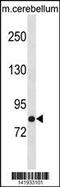 N-Ethylmaleimide Sensitive Factor, Vesicle Fusing ATPase antibody, 60-920, ProSci, Western Blot image 