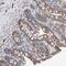 Isoleucyl-TRNA Synthetase 2, Mitochondrial antibody, NBP1-84637, Novus Biologicals, Immunohistochemistry paraffin image 