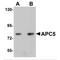 Anaphase Promoting Complex Subunit 5 antibody, MBS151299, MyBioSource, Western Blot image 