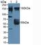 Rho Associated Coiled-Coil Containing Protein Kinase 2 antibody, MBS2027974, MyBioSource, Western Blot image 