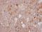 Adrenoceptor Beta 1 antibody, GTX108366, GeneTex, Immunohistochemistry paraffin image 