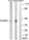 CXADR Ig-Like Cell Adhesion Molecule antibody, abx014400, Abbexa, Western Blot image 