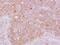 Rho GTPase Activating Protein 5 antibody, NBP2-20158, Novus Biologicals, Immunohistochemistry paraffin image 