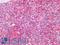 CD33 Molecule antibody, LS-A12005, Lifespan Biosciences, Immunohistochemistry paraffin image 