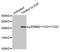 ERBB2 antibody, MBS128528, MyBioSource, Western Blot image 