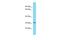 Dihydrouridine Synthase 4 Like antibody, A15943, Boster Biological Technology, Western Blot image 