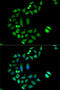 Chloride Intracellular Channel 1 antibody, 15-149, ProSci, Immunofluorescence image 