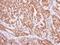 DT-diaphorase antibody, GTX113336, GeneTex, Immunohistochemistry paraffin image 