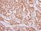 NAD(P)H Quinone Dehydrogenase 1 antibody, GTX113336, GeneTex, Immunohistochemistry paraffin image 