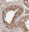 Centromere Protein U antibody, NBP1-85689, Novus Biologicals, Immunohistochemistry frozen image 