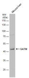 Glycine Amidinotransferase antibody, GTX114423, GeneTex, Western Blot image 