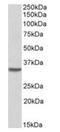 Homeobox C8 antibody, orb20656, Biorbyt, Western Blot image 