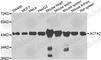 Actin Alpha 2, Smooth Muscle antibody, A7248, ABclonal Technology, Western Blot image 