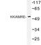 Cyclin Dependent Kinase Like 2 antibody, LS-C176827, Lifespan Biosciences, Western Blot image 