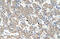 Kynureninase antibody, ARP46037_P050, Aviva Systems Biology, Immunohistochemistry paraffin image 