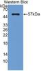 Fibrinogen Beta Chain antibody, abx131869, Abbexa, Western Blot image 