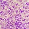 Ribosomal Protein S6 Kinase A6 antibody, GTX55279, GeneTex, Immunohistochemistry paraffin image 