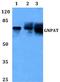 Glyceronephosphate O-Acyltransferase antibody, PA5-36447, Invitrogen Antibodies, Western Blot image 