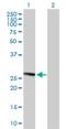 Transmembrane P24 Trafficking Protein 1 antibody, H00011018-B01P, Novus Biologicals, Western Blot image 