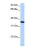 Zinc finger protein 389 antibody, NBP1-91413, Novus Biologicals, Western Blot image 