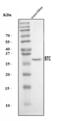 Betacellulin antibody, A02171-4, Boster Biological Technology, Western Blot image 