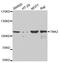 ACK1 antibody, A2526, ABclonal Technology, Western Blot image 