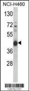 Protein Kinase CAMP-Activated Catalytic Subunit Alpha antibody, MBS9203019, MyBioSource, Western Blot image 