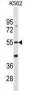 Cyclin-dependent kinase 14 antibody, abx031006, Abbexa, Western Blot image 