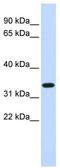 Tripartite motif-containing protein 14 antibody, TA337948, Origene, Western Blot image 