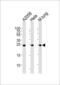 Rho GDP Dissociation Inhibitor Alpha antibody, 61-585, ProSci, Western Blot image 