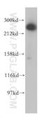 Activating signal cointegrator 1 complex subunit 3 antibody, 17627-1-AP, Proteintech Group, Western Blot image 