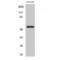 STEAP3 Metalloreductase antibody, LS-C385480, Lifespan Biosciences, Western Blot image 