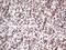 GLI Family Zinc Finger 4 antibody, NBP2-45874, Novus Biologicals, Immunohistochemistry paraffin image 