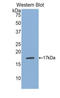 Phospholipase A1 member A antibody, LS-C297964, Lifespan Biosciences, Western Blot image 