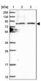 TBC1 Domain Family Member 30 antibody, PA5-58923, Invitrogen Antibodies, Western Blot image 