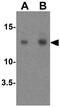 GABA Type A Receptor Associated Protein Like 2 antibody, GTX31584, GeneTex, Western Blot image 