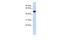 Translocation Associated Membrane Protein 1 Like 1 antibody, A18207, Boster Biological Technology, Western Blot image 