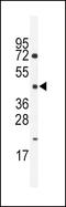 Hepatocyte Nuclear Factor 4 Gamma antibody, LS-C100655, Lifespan Biosciences, Western Blot image 