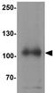 Signal-Induced Proliferation-Associated 1 antibody, GTX31846, GeneTex, Western Blot image 
