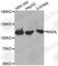 Ras-associating and dilute domain-containing protein antibody, A3455, ABclonal Technology, Western Blot image 