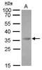 Programmed Cell Death 1 antibody, GTX128436, GeneTex, Western Blot image 